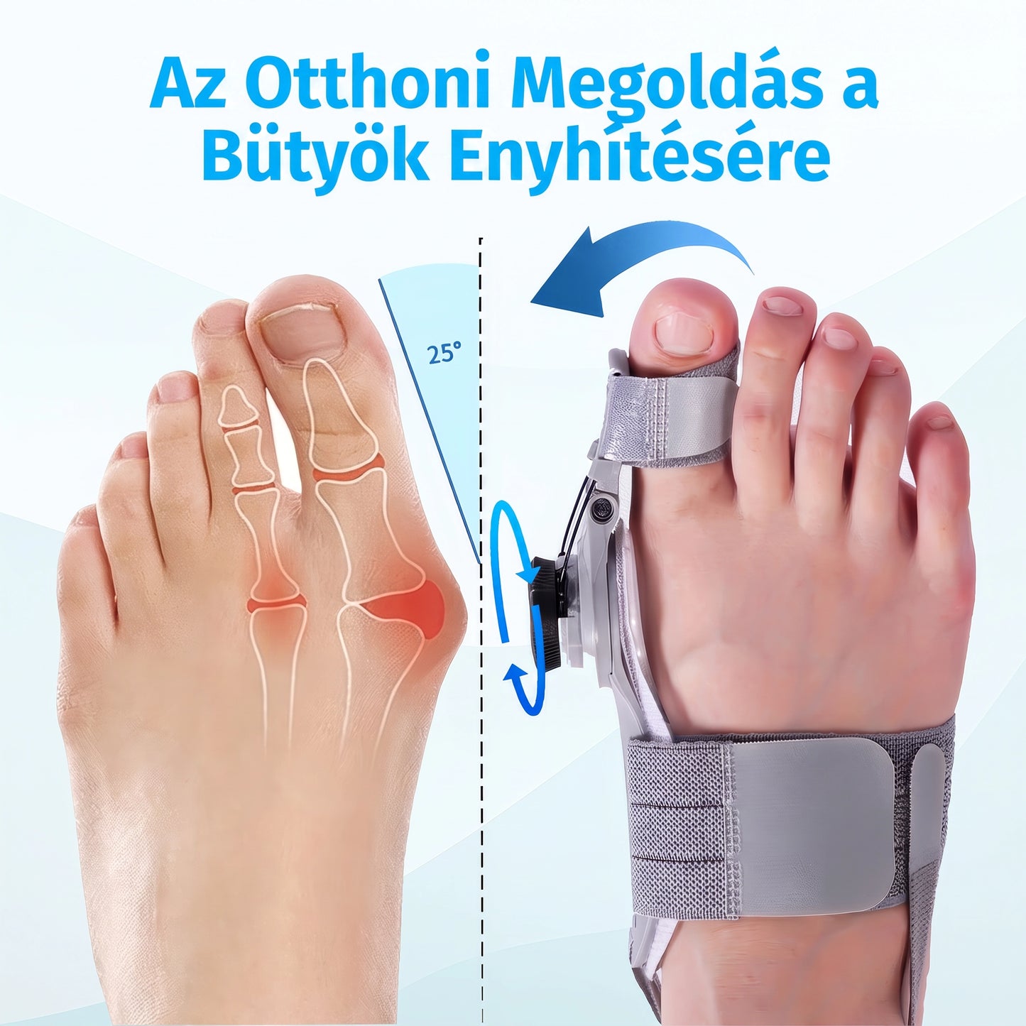 Toesy™ - Bütyök fixáló
