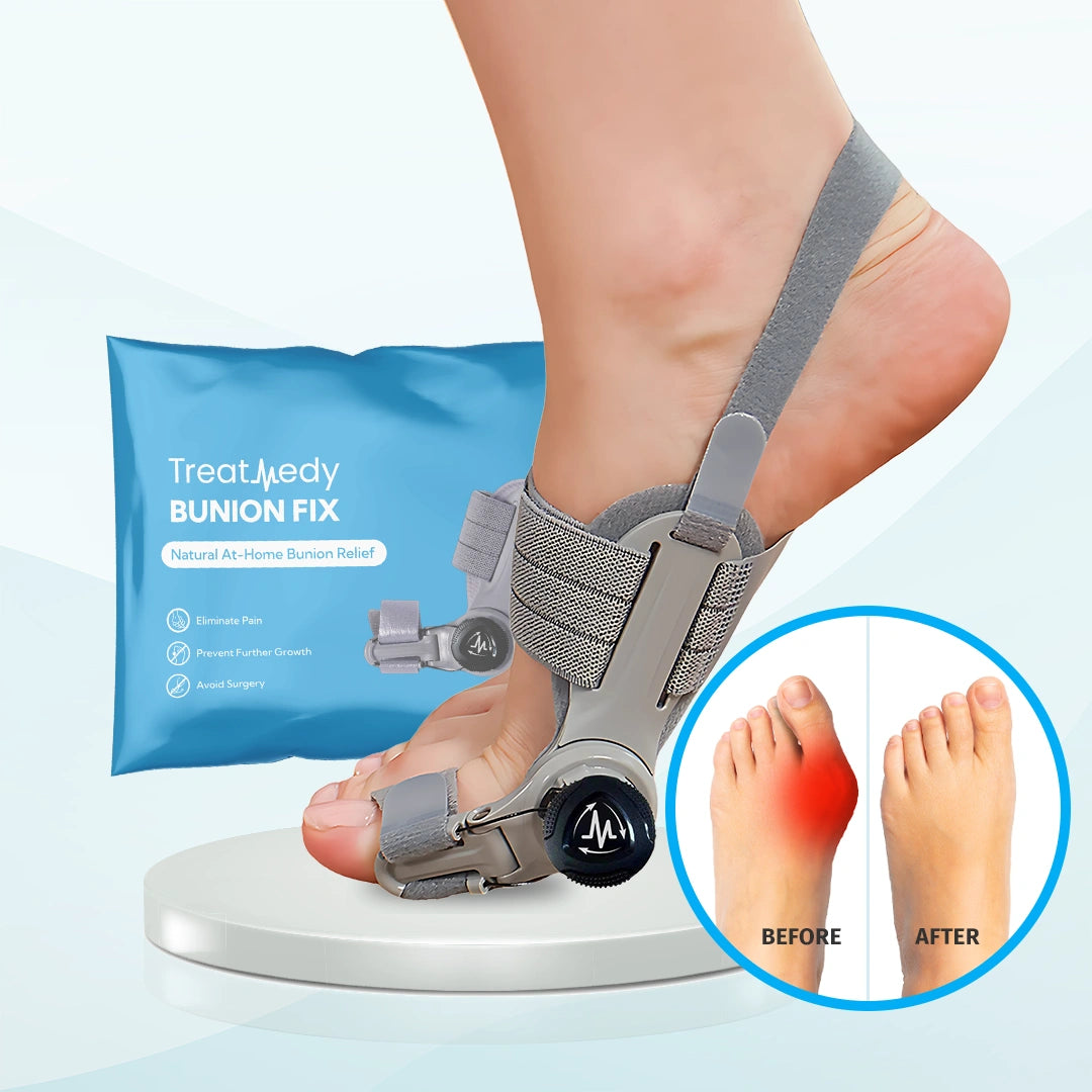 Toesy™ - Bütyök fixáló