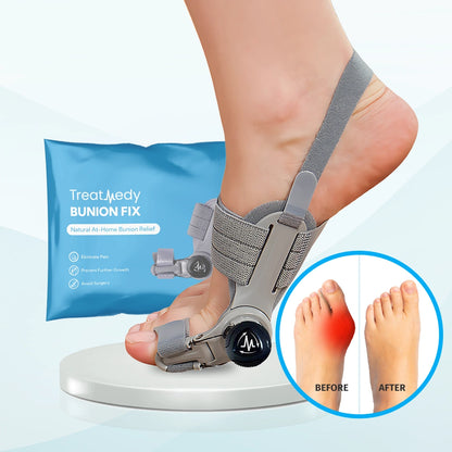 Toesy™ - Bütyök fixáló